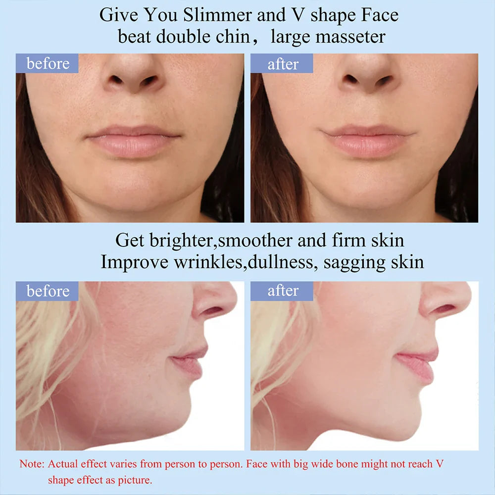 EMS Lymphatic Massage Device